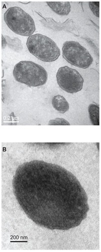 Figure 3 Transmission electron micrograph of calcifying nanoparticles cultured in vitro for four weeks. (A) Calcifying nanoparticles appear as oval-shaped particles with highly electron-dense shells. (B) Calcifying nanoparticles without shells.Note: Bar indicates magnification of 200 nm.