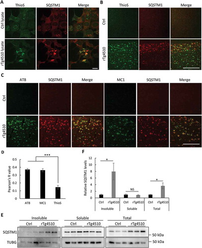 Figure 4. Mutant MAPT aggregates associate with SQSTM1. (a) Representative fluorescence images of ThioS, SQSTM1 or combined (Merge) of MAPT-PL-V5-expressing HEK293 cells seeded with control (Ctrl) or MAPT (rTg4510) lysates, showing a high degree of colocalization between SQSTM1 and ThioS. (b) Representative costaining images in the cortex of rTg4510 mice showing similar colocalization of SQSTM1 with ThioS. (c) Representative costaining images in the cortex of rTg4510 mice showing similar colocalization of SQSTM1 with AT8 and MC1. (d) Quantification of colocalization between SQSTM1 and ThioS, AT8, and MC1 in (b) and (c). (e) Representative western blot image of SQSTM1 in control (Ctrl) or rTg4510 in insoluble or soluble fractions or total brain lysates (Total). (f) Quantification of relative levels of SQSTM1:TUBG (n = 3). Scale Bar: 20 μm in (a); 200 μm in (b) and (c). All data are expressed as mean ± SEM. NS, non-significant; *P ≤ 0.05; ***P ≤ 0.001.