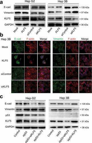 Figure 1. KLF5 regulates EMT marker expression in the context of p53 loss. (a). The expression levels of the EMT markers E-cadherin and vimentin were regulated by KLF5 in the p53-null cell line Hep3B (right), while in p53 wild type HepG2 cells, the expression levels of E-cadherin and vimentin were not altered (left). (b). Changes in the expression levels of E-cadherin and vimentin were examined by immunofluorescence staining in Hep3B cells after KLF5 overexpression or knock-down. F-actin (actin cytoskeleton) staining was used to show the cell morphology. Scale bar = 50 µm. (c). KLF5 expression altered the E-cadherin and vimentin expression levels in HepG2 cells after p53 silencing and in p53-null Hep3B cells, which suggests that the p53 status influenced the function of KLF5 in liver cancer cell EMT.