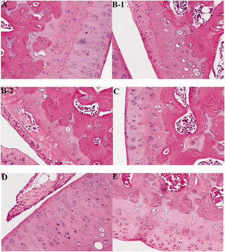 Figure 9. Compound 5e recovers RA histopathological features of rats. (A) Normal control group (Ctrl, normal saline), (B-1, B-2) model group (model, normal saline), (C) low-dose compound 5e group (30 mg/kg), (D) high-dose compound 5e Group (60 mg/kg), and (E) positive control MTX (30 mg/kg). (n = 5 per group).