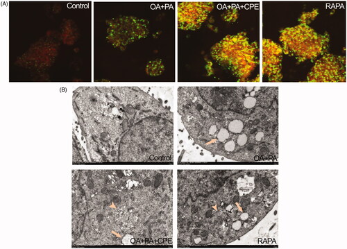 Figure 4. Role of autolysosomes in CPE-mediated clearance of intracellular lipid in HepG2 cells. (A) HepG2 cells treated with 50 μg/mL of CPE or 1 μM of rapamycin (RAPA) for 24 h after 0.5 mM of OA + PA mixture treatment for 16 h, followed by double labelling with Lyso-tracker red (red) and Bodipy493/503 (green) showed increased colocalization of autolysosomes and cellular lipids (yellow dots) vs. OA and PA treated cells and no lipid-treated cells. (B) Electron micrograph images of HepG2 cells treated with 50 μg/mL of CPE or 1 μM of RAPA for 24 h after 0.5 mM of OA + PA mixture treatment for 16 h showed autolysosomes filled with lipids vs. OA and PA treated cells and no lipid-treated cells. Arrow indicated the lipid droplets and autolysosome structure was denoted with arrow heads. RAPA was used as a positive control.