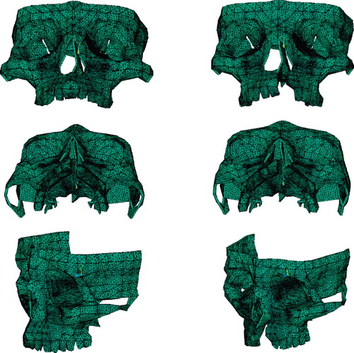 Figure 4.  Representative models designed by computer viewed from different angles for the intact model group (left column) and cleft model group (right column), respectively.