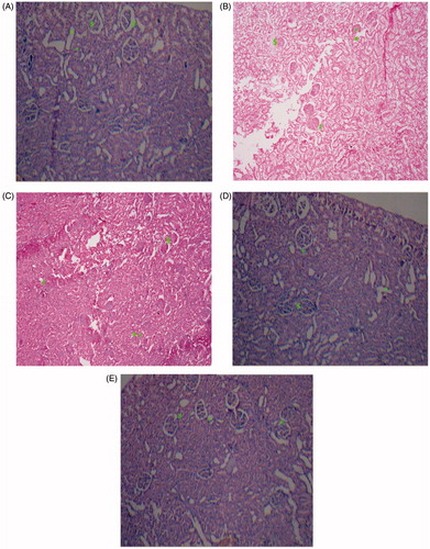 Figure 6. Light microscopy of kidney tissues from rats (HE stained kidney sections). (A) Control group, (B) Diabetic control group, (C) Coenzyme Q10 (D) Sitagliptin (E) Coenzyme Q10 + Sitagliptin.