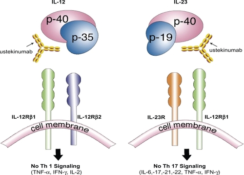 Figure 1 Ustekinumab, a human monoclonal antibody, works by inhibiting the similar p40 subunit of the proteins IL-12 and IL-23. Both IL-12 and IL-23 proteins are necessary to activate a cascade of inflammatory mediators responsible in the pathogenesis of psoriasis. Ustekinumab’s inhibition of the IL-12/23 pathway produces a profound suppression of both the Th1 and Th17 cell lineage of cytokines and chemokines resulting in a dramatic clearance of psoriasis.