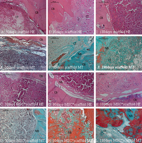 Figure 4. A–L show the healing stages of the critical sized defect (cavity) filled with the biocompatible polymeric biomaterial guided well organized fibrous callus. Note that the implant allow an intramembranous bone formation through this callus/connective tissue witihin its 3D pores from the 90th to 180th days in E–L. New bone trabecules are apparent in green with MT stain in F, J; and L. CB: Compact bone, NB: New bone, I: Implant, CT: Connective tissue, HE: Haematoxylin & Eosin, MSC*: mesenchymal stem cell, MT: Masson's Trichrome.