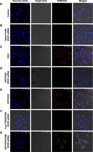 Figure 8 Confocal images of the HeLa cells. (A) Blank control, (B) naked FAM-VEGF-siRNA, (C) DOX, (D) GPF/FAM-VEGF-siRNA, (E) GPF/DOX, (F) Lipo™2000/FAM-VEGF-siRNA, and (G) GPF/DOX/FAM-VEGF-siRNA.Abbreviations: DOX, doxorubicin; GPF, graphene oxide-poly-l-lysine hydrobromide/folic acid; siRNA, small interfering RNA; VEGF, vascular endothelial growth factor.