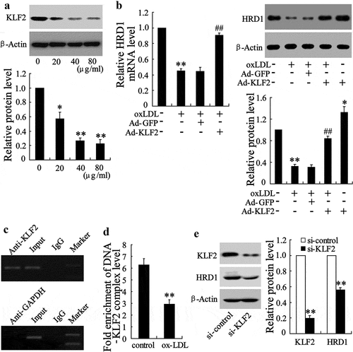 Figure 3. HRD1 expression is regulated by KLF2 in endothelial cells treated with ox-LDL. (a) Human umbilical vein endothelial cells (HUVECs) were treated with ox-LDL (0, 20, 40 and 80 μg/ml) for 24 h, followed by measurement of the KLF2 expression. (b) HUVECs were transfected with Ad-GFP or Ad-KLF2 for 24 h followed by exposure to ox-LDL (80 μg/ml) for 24 h and measurement of HRD1 mRNA and protein levels. (c) KLF2 bound to the HRD1 promoter in HUVECs in a ChIP analysis. (d) ChIP-qPCR analysis was performed to measure the capacity of KLF2 binding to the HRD1 promoter in HUVECs treated with ox-LDL. (e) HUVECs were transfected with KLF2 siRNA (si-KLF2) for 24 h, followed by measurement of KLF2 and HRD1 expression. Values are means ± SD and are representative of three individual experiments. *P < 0.05 and **P < 0.01, compared to control. ##P < 0.01, compared to ox-LDL + Ad-GFP.