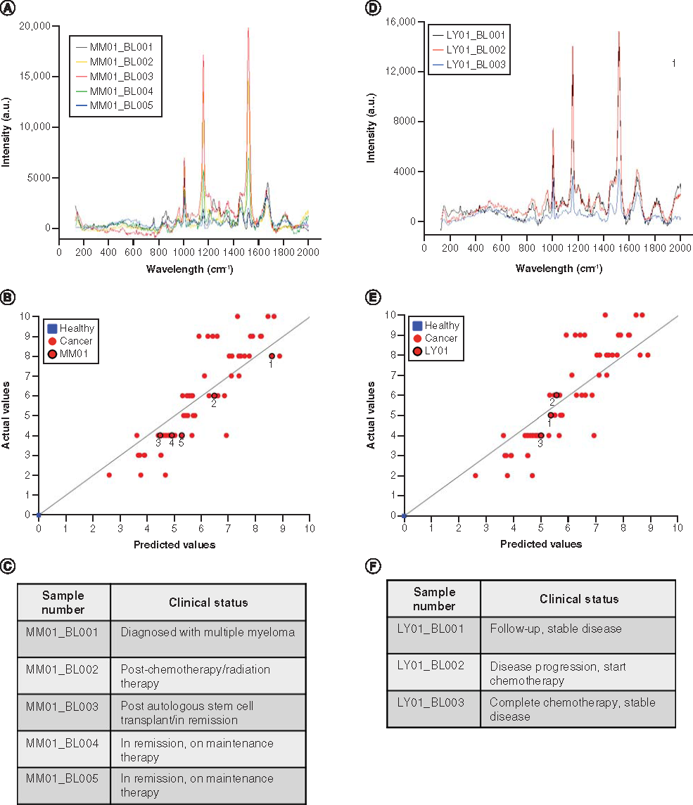 Figure 4. nanoSERS predictive model correlates with assigned disease severity scores. (A) A representative example of serial nanoSERS spectra from a patient with MM (B) and highlighted in predictive model correlating predictive disease severity scores (C) with clinical status. (D) A representative example of serial nanoSERS spectra from a patient with lymphoma (E) and highlighted in predictive model correlating predictive disease severity scores (F) with clinical status.BL: Blood; LY: Lymphoma; MM: Multiple myeloma.