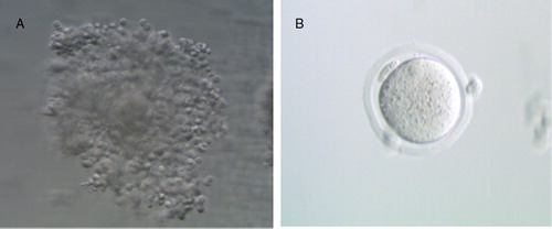 Figure 2. Isolated Preantral Mouse Oocytes. A) Cumulus oocyte complex. B) Oocyte complex with cumulus cells removed through digestion with hyaluronic acid.