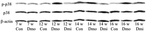 Figure 4. Protein expression of p38 and p-p38 in islets. p-p38, phosphorylated p38; Con, C57 mice; Dmo, vehicle-treated db/db mice; Dmi, SB203580-treated db/db mice.