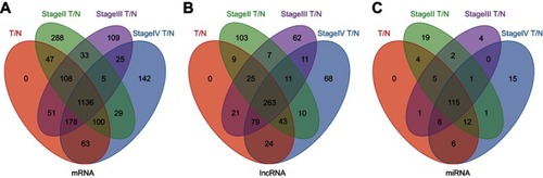 Figure 2 Venn diagram analysis of aberrantly expressed (A) mRNAs, (B) lncRNAs and (C) miRNAs between all MIBC tissue samples, 3 tumor stages (stage Ⅱ, Ⅲ and Ⅳ) and nontumor tissues.Abbreviations: MIBC, Muscle-invasive bladder cancer; T, tumor tissues; N, adjacent nontumor tissues.