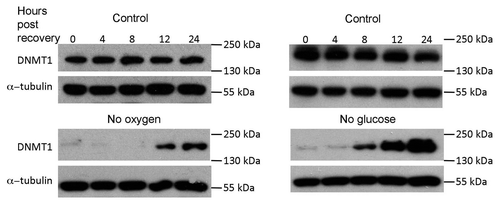 Figure 6 Western blot showing recovery of DNMT1 protein levels in HCT116 cells after 24 h in no oxygen or no glucose. Protein was collected after cells were restored to normal conditions for 0, 4, 8, 12 and 24 h.