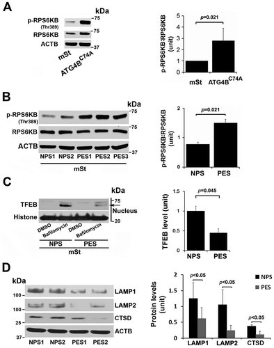 Figure 7. MTORC1 activation in autophagy-deficient ATG4C74A cells and lack of TFEB nuclear translocation in mSt cells in response to sera from PE patients. (A) Increased MTORC1 activity was observed in ATG4BC74A cells that show higher ratio of p-RPS6KB:RPS6KB. (B) PE sera (PES), not NP sera (NPS), increase phosphorylation of MTORC1 target, RPS6KB. (C) A representative western blot shows evidence for PES-mediated block of TFEB nuclear translocation. mSt cells were treated with NPS or PES samples for 24 h in the presence of bafilomycin A1, and nuclear protein fraction was then isolated. (D) PES, not NPS, downregulated the expression of LAMP1, LAMP2 and CTSD in mSt cells. Data are presented as mean ± SEM with at least n = 3 per group, and analyzed by a Student t-test.
