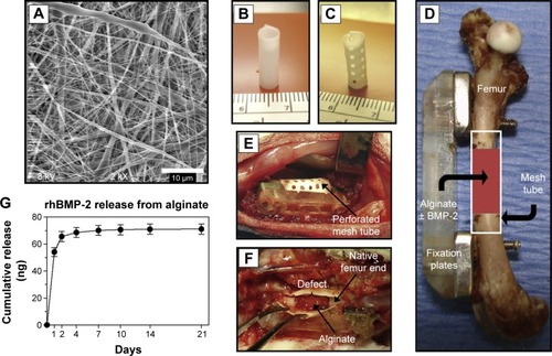 Figure 3 An alginate-based hybrid system consisting of electrospun nanofibrous mesh for growth factor delivery and bone repair.Notes: (A) Scanning electron micrograph of electrospun nanofibrous mesh illustrating the smooth and bead-free nanofibers. Tubular bone implants made from nanofibrous mesh (B) without and (C) with perforations. (D) Scheme of mesh tube implant in segmental bone defect, where modular fixation plates are used to stabilize the bone and a nanofibrous mesh tube is placed in a defect 8 mm long. Also, alginate hydrogel with or without rhBMP-2 may be injected into the hollow tube. (E) Photograph of the surgical site after placing a perforated mesh tube. (F) The mesh tube was retrieved 1 week after implantation and the mesh tube was cut open, where the alginate was still present inside the defect. (G) Curve showing release kinetics of rhBMP-2 from alginate over 21 days in vitro, and sustained release of the rhBMP-2 was observed during the 1st week. Reproduced from Biomaterials. Vol 32. Kolambkar YM, Dupont KM, Boerckel JD. An alginate-based hybrid system for growth factor delivery in the functional repair of large bone defects. 65–74. 2011, with permission from Elsevier.Citation71Abbreviation: rhBMP, recombinant human bone morphogenetic protein-2.