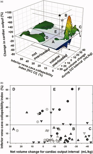 Figure 1. (a) Relationship of change in CO to “net volume” change within CO interval and to IVC CI depicted as a 3-D scattergram with smoothing. Solid symbols indicate intermittent HD encounters and open symbols indicate continuous HD encounters. Upward triangles indicate CO increased > 10%, downward triangles indicate CO decreased > 10%, circles indicate CO changed −10% to +10%. Stars indicate CO “outliers” on the mesh plot. IVC CI < 20% was indicated as relative intravascular volume overload and IVC CI ≥ 20% as not volume overloaded. The flat plane indicates zero per cent change in CO. Sectors labeled A, B, C, D, E, and F correspond to Figure 1(b). (b) Relationship of IVC CI to “net volume” change between CO measurements, CO change, and intradialytic hypotension. Symbols are as in Figure 1(a). Encounter data are grouped based on IVC CI <20% versus ≥20%. The “net volume” change cutoffs were arbitrarily at −7 mL/kg and −30 mL/kg. The numbers inside of the symbols indicate the severity of intradialytic hypotension (IDH) (number 1 = IDH 2a, 2 = IDH 2b, 3 = IDH 3, and 4 = IDH 4). For IVC CI < 20%, sector A represents “net volume” change of < −7 mL/kg (n = 12), sector B represents “net volume” change −7 to −30 mL/kg (n = 24), and sector C represents “net volume” change of more than −30 mL/kg (n = 6). For IVC CI ≥ 20%, D represents “net volume” change of < −7 mL/kg (n = 8), E represents “net volume” change −7 to −30 mL/kg (n = 7), F represents “net volume” change of more than −30 mL/kg (n = 1).