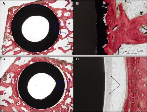 Figure 10 Histology results at 12 weeks for a representative Ti-PEEK implant (A, B) compared to an uncoated PEEK implant (C, D).