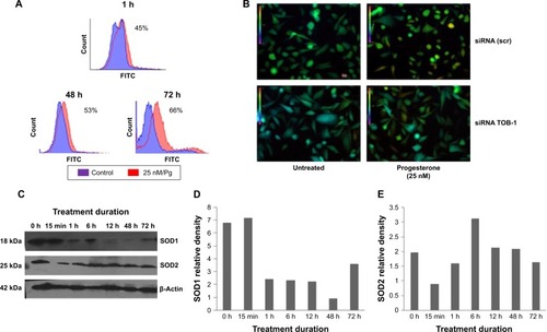 Figure 7 Progesterone-induced ROS production in MCF-7 cell lines.