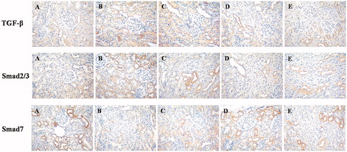 Figure 3. Photomicrographs of representative immunohistochemical staining sections of kidney (200× magnification). (A) Control group; (B) STZ group. (C) DMP-1 low dose group; (D) DMP-1 medium dose group; (E) DMP-1 high dose group.