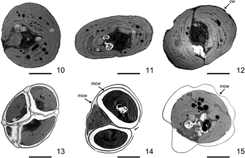 Figs 10–15. Ultrastructure of Lunachloris lukesovae CCALA 307. Figs 10–12. Vegetative cells (remnants of mother cell wall are not shown). Figs 13–14. Autosporangia. Fig. 15. Vegetative cell surrounded by mother cell wall after autospore release. ch, chloroplast; m, mitochondrion; n, nucleus, s, starch; th, thylakoids; cw, cell wall; mcw, mother cell wall; pg, plastoglobuli. Scale = 1 µm.