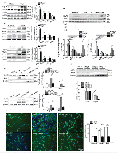 Figure 3. NOX4 activated Xbp1s in cardiac hypertrophy. (A) Western blotting analysis for Xbp1s in rats 4 weeks after TAC or sham surgery. n = 6. * indicates P<0.05 vs. sham-operated group. (B) Western blotting analysis for Xbp1s in NCMs treated with AngII (10−5M for 24h, Top) or ISO (10−5M for 24h, Bottom). n = 4. * indicates P<0.05 vs. control. (C) Western blotting analysis for Xbp1s in NCMs in the presence or absence of AngII (10−5M for 24h, Top) or ISO (10−5M for 24h, Bottom) after transfected with si-Con or siNOX4. n = 4. * indicates P<0.05 vs. si-Con; # indicates P<0.05 vs. siNOX4+AngII or siNOX4+ISO. (D) Western blotting analysis for Xbp1s signaling in NCMs of indicated groups. NCMs treated with AngII (10−5M for 24h), ISO (10−5M for 24h) or H2O2 (100μM for 2h) showed significantly higher activation of Xbp1 compared to blank group. The activation of Xbp1 was restored by pretreatment with either NAC (10mM for 1h) or GKT137831(5μM for 1h). n = 3. *, ## indicates P<0.05 vs. blank group and DMSO group, respectively; ** indicates P<0.05(AngII, ISO, H2O2 group vs. AngII+NAC, ISO+NAC, H2O2+NAC group, respectively); # indicates P<0.05(AngII and ISO group vs. AngII+GKT137831 and ISO+ GKT137831group, respectively). (E) Western blotting analysis for Xbp1 and NOX4 in NCMs transfected with si-Con or siXbp1(1–3). n = 3. * indicates P<0.05 vs. si-Con group. (F) Surface area determination of NCMs in the presence or absence of AngII (10−5M for 24h) or ISO (10−5M for 24h) after transfected with si-Con or siXBP1. n = 4. The fluorescent micrograph is representative of cells from 4 independent visual fields.