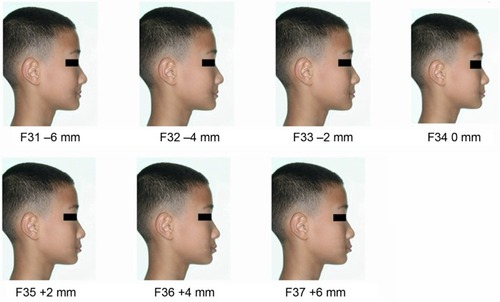 Figure 3 Models of chromophotograph of the boy with different lip positions (F31–F37).