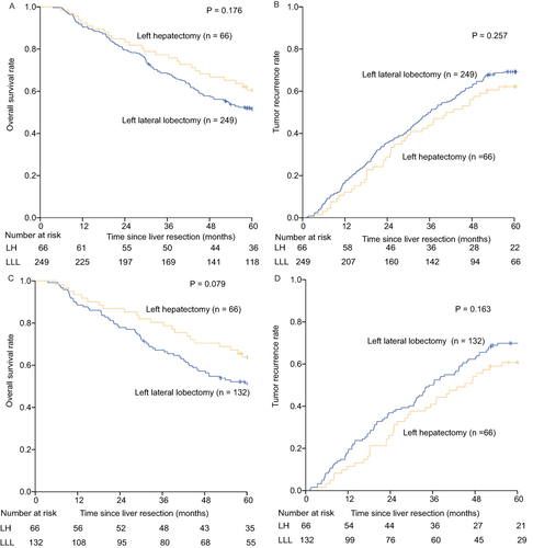 Figure 2 Overall survival and tumor recurrence curves of patients with HCC on the left lateral lobe in the LH group and LLL group before and after propensity score matching. (A) Overall survival curve before propensity score matching; (B) Tumor recurrence curve before propensity score matching; (C) Overall survival curve after propensity score matching; (D) Tumor recurrence curve after propensity score matching.