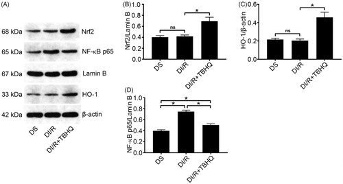 Figure 6. TBHQ pretreatment activates the Nrf2/HO-1 pathway and inhibits NF-κB expression after I/R in diabetic rats. (A) Representative western blotting images and quantification of protein levels of (B) Nrf2, (C) HO-1, and (D) NF-κB. The results are presented as mean ± SD. *p < .05.