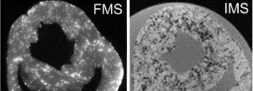 Figure 1. High resolution images of deposition pattern of fluorescent MS (FMS) and iron oxide MS (IMS) from different myocardial slices.