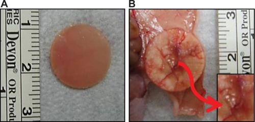Figure 9 Gross view of hMSCs seeded CS/SF/30%nHAP NMS.Note: View before (A) and 8 weeks after (B) subcutaneous implantation in nude mice. Vascularized zones on top of the NMS are shown at insert of (B).Abbreviations: ALP, alkaline phosphatase; hMSCs, human bone marrow mesenchymal stem cells; CS, chitosan; SF, silk fibroin; nHAP, nanohydroxyapatite; NMS, nanofibrous membrane scaffold.