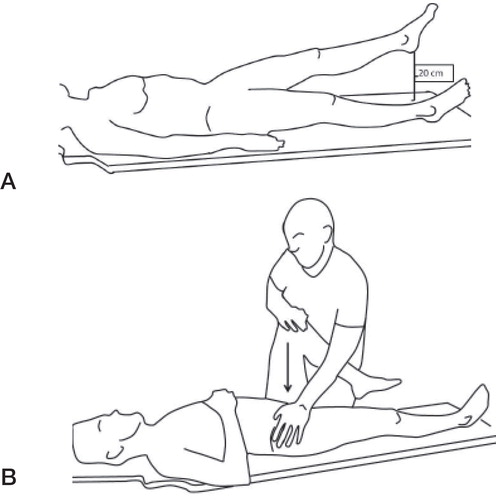 Figure 1. A. Active straight leg raise (ASLR). The patient lifts the leg 20 cm from the bench and grades the difficulty of performing this action between 0 (no problem) and 5 (impossible). B. Posterior pelvic pain provocation test (P4). A gentle press is made on the flexed leg, and the test is positive if a familiar pain is reproduced in the posterior gluteal region.