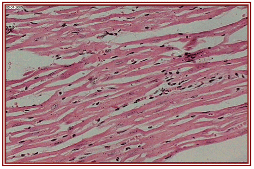 Figure 2.  STZ treated group (i.e. group II) rat heart section, showing mild edema (×10).