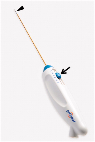 Figure 2. A photograph of the Proteus RF Electrode. The length of noninsulated electrode (arrowhead) is controlled from 0.5 to 3 cm in the handle (arrow).