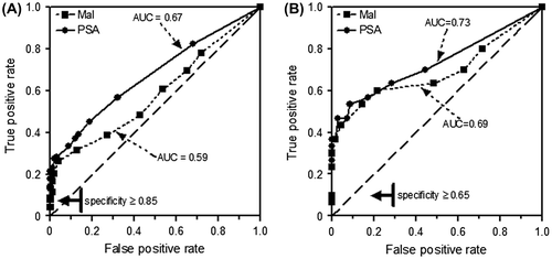 Figure 4. Comparison of ROC curves for malignancy index (Mal) and PSA level. (A) Mal obtained from needle biopsies of 217 patients. (B) Mal obtained from TURP tissues of 100 patients. PSA was routinely measured.