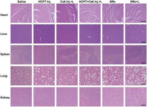 Figure 9 H&E stained histological images obtained from main organs (heart, liver, spleen, lung, and kidney) of 4T1 tumor-bearing mice after treated with various formulations. Scale bar: 100 μm.Abbreviations: Inj., injection; L, laser; NRs, nanorods; HCPT, 10-hydroxycamptothecine; Ce6, Chlorin e6.