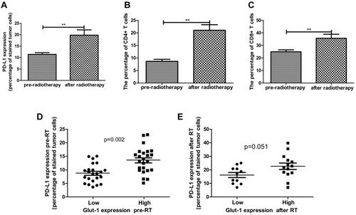Figure 3 Alteration of PD-L1, and CD4+, CD8+ T cells after RT compared with pre-RT. (A) PD-L1 expression in tumor cells was significantly increased after RT compared with pre-RT. (B) CD4+ T cell infiltration was markedly increased after RT. (C) CD8+ T cell infiltration was markedly increased after RT. (D) Expression of PD-L1 was correlated with the expression of GLUT1 in pre-RT specimens. (E) PD-L1 expression tended to correlate with the expression of GLUT1 after RT (**p<0.01).