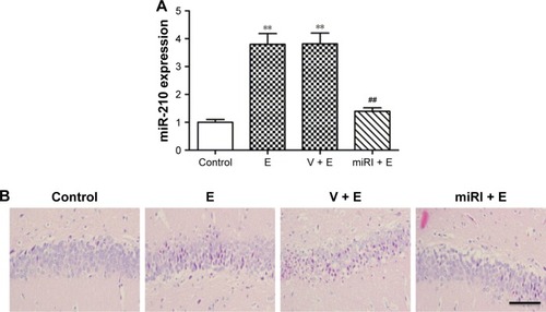 Figure 2 miR-210 inhibitor prohibited epilepsy-induced morphological changes.