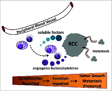 Figure 1. Role for soluble RCC tumor products in reduced function of tumor infiltrating immune cells to promote tumor outgrowth and metastasis. Peripheral blood lymphocytes are recruited to the developing renal tumor (RCC) and their activity is impaired in the tumor environment when encountering soluble products. The effect is suppression and/or loss of cytotoxic capacity and conversion to a program that favors the production of angiogenic factors and cytokines that support tumor growth and promote dissemination (metastasis) to distant organ sites.