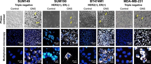 Figure 2 GNS uptake in IBC (SUM149 & SUM190) and non-IBC (BT474M1 & MDA-MB-231) cell lines. Receptor statuses are provided beneath each represented cell line. The cell lines were incubated with 0.15 nM GNS for 24 hours, washed to remove free particles, stained with Hoechst 33342, and imaged via MPM. The GNS appear as black particles within the cells under phase-contrast imaging (yellow arrows; scale bars =100 μm). Under MPM, the GNS in the cell cytoplasm appear white in color.Abbreviations: GNS, gold nanostars; MPM, multiphoton microscopy; IBC, inflammatory breast cancer.