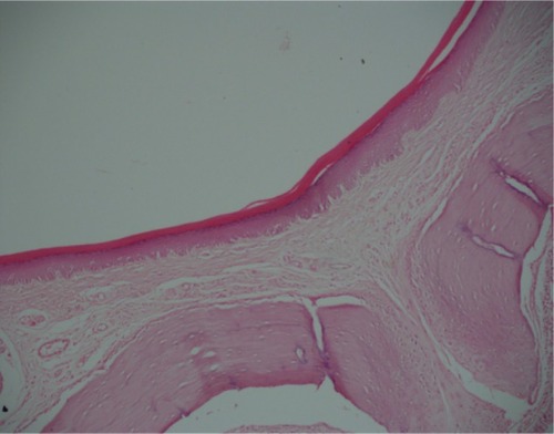 Figure 11 Caffeic acid phenethyl ester group at day 14.Note: Increased fibrous tissue under the near-normal epithelial layer (hematoxylin and eosin, 100×).