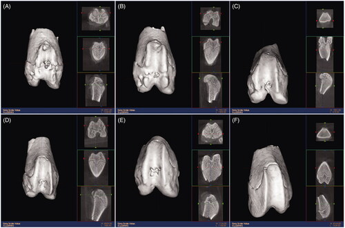 Figure 7. 3D reconstruction by microCT and iconography observation of the knee joints. (A–E) The knee joint of groups A–E; (F) sham group.