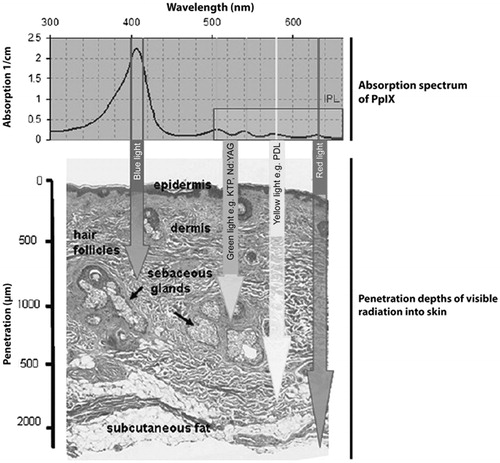 Figure 1. Wavelength-dependent penetration of blue, green, yellow and red light in PDT. Arrows indicate the approximate 50% optical penetration depth in human skin. Reproduced with permission (Citation34).