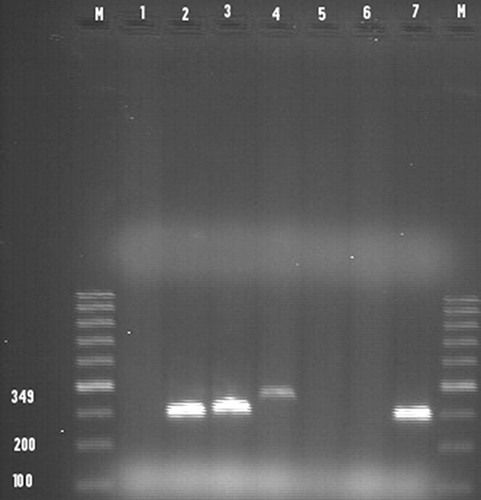 Figure 3 Conventional PCR products of stx1 gene with an amplicon size of 349 bp run on gel electrophoresis for E.coli O157:H7 isolates.