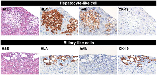 Figure 2. Reconstitution of human liver structures from differentiated HepaRG® cells in vivo. Hepatocyte-like colonies (upper panel) and biliary-like colonies (lower panel) in a TK-NOG mouse liver that was transplanted with differentiation D35 HepaRG® cells were subjected to immunohistochemical analysis. Serial liver sections were stained for H&E, HLA, hAlb and CK-19. Bar = 100 μm.