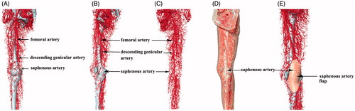 Figure 1. CT scanning image reconstruction of saphenous artery and its surrounding blood vessels in perfusion specimen. (A, B and C) Surface reconstruction femoral artery, descending genicular artery and saphenous artery. (D and E) The projection on the body surface and the scope of the saphenous artery and saphenous artery flap.