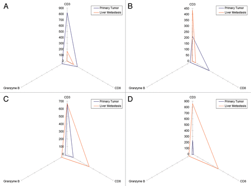 Figure 3. Immune cell infiltration of primary colorectal carcinoma lesions and hepatic colorectal carcinoma metastases. (A–D) Triangles represent the amount of CD3+,CD8+ and granzyme B+ cells detected in primary tumors and the corresponding metastasis. All axes show cell density (cells/mm2) and have the same scale.