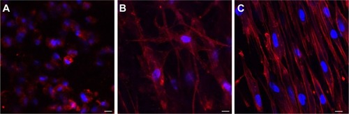 Figure 9 Confocal images of scaffolds containing cells after (A) 1 day, (B) 7 days, and (C) 15 days of cultivation.Notes: Original magnifications: ×40 with 2× zoom. Scale bars represent 10 um.