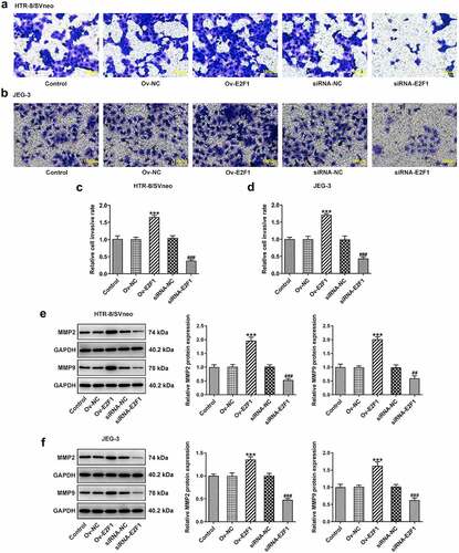 Figure 2. E2F1 enhances the invasiveness of trophoblast cells. HTR-8/SVneo and JEG-3 cells were transfected with Ov-E2F1 or siRNA-E2F1. (a–d) Transwell assays for determination of trophoblast invasion. (e, f) Western blot assay for determination of MMP2 and MMP9 expressions. ***p < 0.001 versus Ov-NC, ##p < 0.01, ###p < 0.001 versus siRNA-NC.