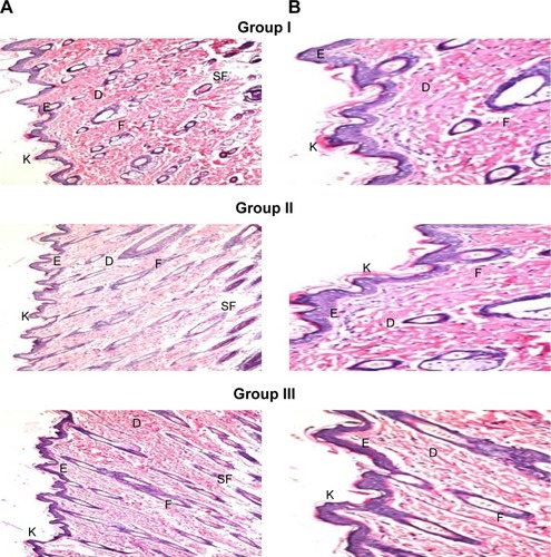 Figure 6 Photomicrographs showing histopathological sections (H&E stained) of normal untreated rat skin (group I), rat skin treated with OLM suspension (group II), and rat skin treated with TE14 (group III). The magnification power of ×16 (A) to illustrate all skin layers and ×40 (B) to identify the epidermis and dermis, respectively.Abbreviations: D, dermis; E, epidermis; F, hair follicles; K, keratin; OLM, olmesartan medoxomil; SF, subcutaneous fat; TE, transethosome.