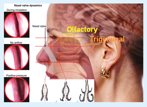 Figure 2. The complex nasal anatomy and the nasal valve.Cross-sections of the complex nasal passages and endoscopic images highlighting the small dimensions and narrow geometry of the nasal valve, as well as its dynamics during nasal inhalation and when a positive pressure is applied. The target sites for N2B delivery are located in the upperconvoluted slit-like nasal passages beyond this narrow anterior nasal valve.Reproduced with permission from [Citation132].