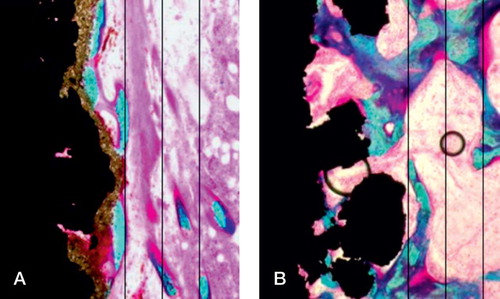 Figure 2. Images from histomorphometry. A. hydroxyapatite-coated implant. B. Growth factor-coated implant. The lines indicate the inner and outer zones where the tissue volume is measured. Ongrowth is defined as tissue in direct contact with the implant surface or the hydroxyapatite coating.